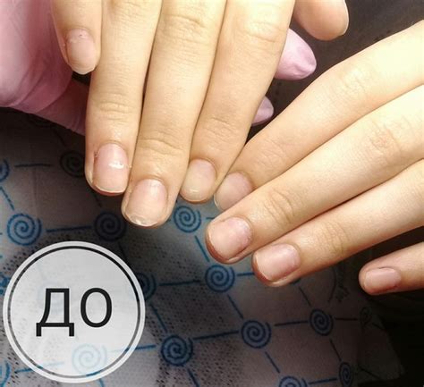 Можно ли наращивать ногти в 15 лет: С какого возраста можно наращивать ...
