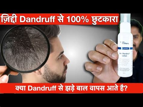 dandruff se chutkara kaise paye kya dandruff se hair fall hota hai