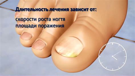 Как действует Микозан — официальный ролик - YouTube