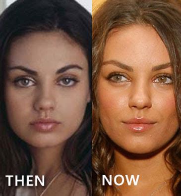 Mila Kunis Nose Job | Mila Kunis Pictures