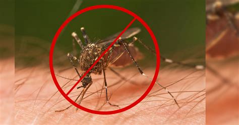 6 Home Remedies That Will Make You Itch-Free This Summer