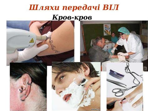 ВІЛ. СНІД. - скачать презентацию