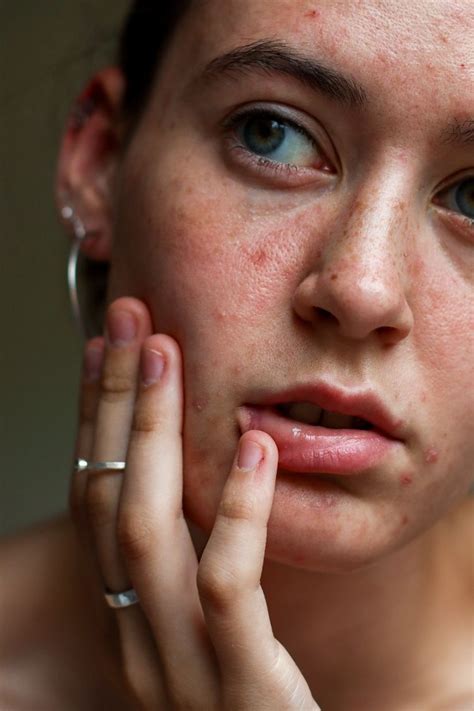 Pin by a sy on جمال خاص | Clear skin, Skin care routine, Facial skin ...