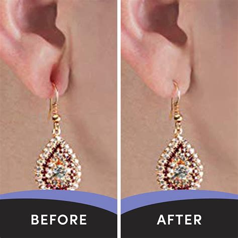 Lobe Miracle Clear Earring Support Patches - Ear Care for Droopy, Torn