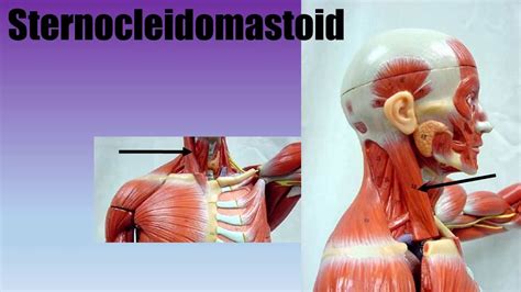 Muscle Actions: Sternocleidomastoid - YouTube