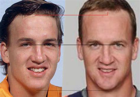 Peyton Manning Forehead Jokes