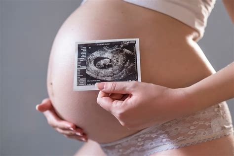 Gravida Pode Fazer Raio X - Mulher grávida segurando um raio-x na frente da barriga alta | Foto Grátis