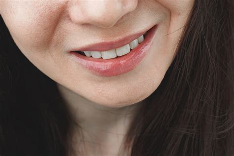 Calgary Perioral Dermatitis Relief: Find Natural Solutions with