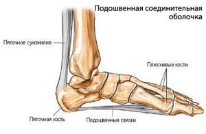 Подошвенный (плантарный ) фасциит:причины, лечение и профилактика