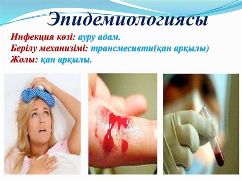 Брилл-Цинссер ауруы - презентация онлайн