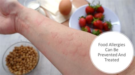 Food Allergy Freedom: Proven Ways for Prevention and Treatment