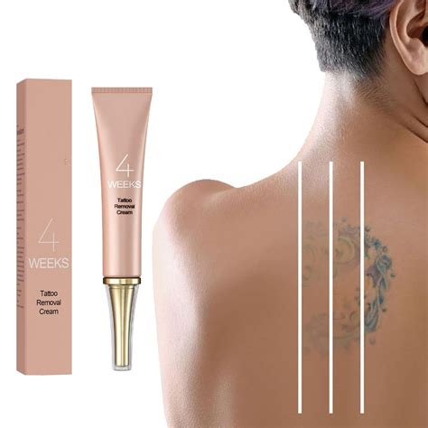 tattoo removal cream 7