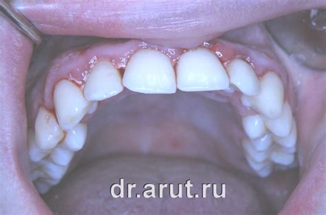 Пародонтология — Стоматология