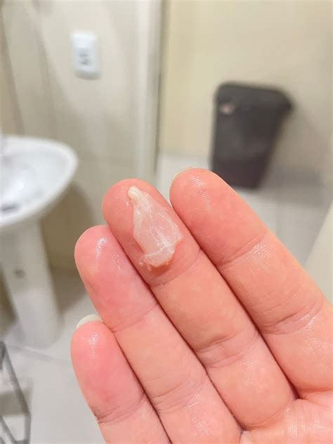 Com Quantos Dedos De Dilatação Sai O Tampão - Tampão mucoso| DPP 29/09 | 1cm de dilatação | | BabyCenter