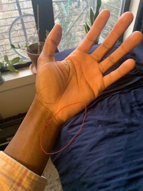 Dull, consistent, daily pain on pinky-side of fretting hand — what am I