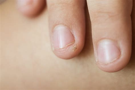 Jesse Switch: The Science Behind The Viral Sensation. Image 17