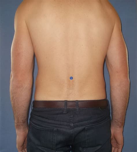 gv   element acupressure