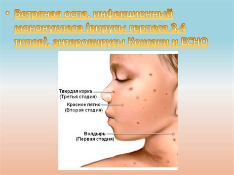 Кожные заболевания у детей и их профилактика - презентация онлайн