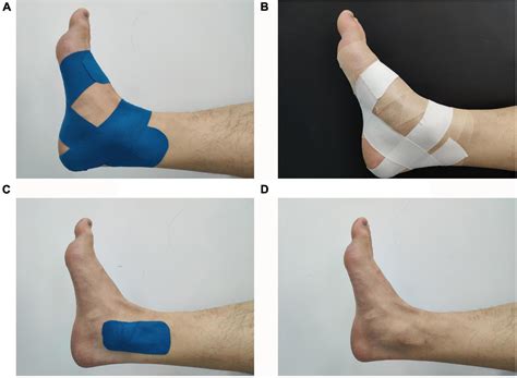 Frontiers | Effect of Kinesiology Tape on Muscle Activation of Lower