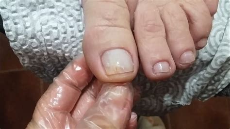 Unhas Rachadas Desde A Raiz - Unhas, reconstruindo unhas rachadas, passo a passo #107 - YouTube