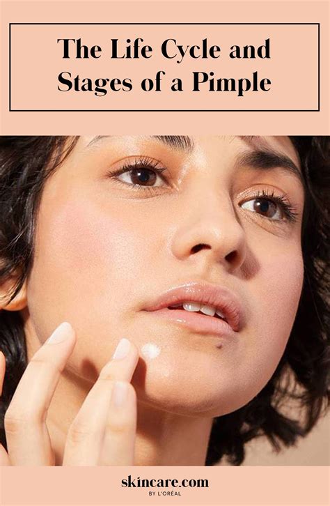 how to rid pimples 16