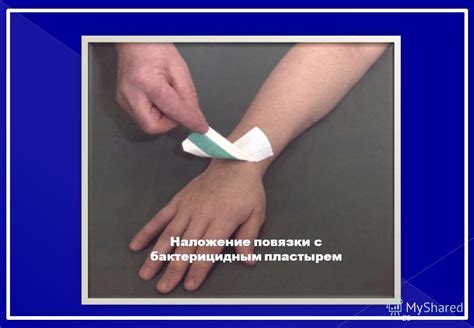 Презентация на тему: ""Десмургия" ГАОУ СПО "Оренбургский областной ...