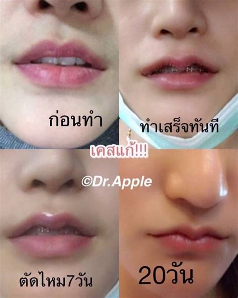 cara membuat bibir berbentuk love