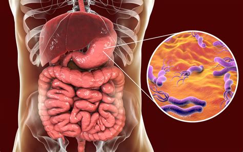 Helicobacter pylori, bacteria care poate declansa cancerul de stomac ...