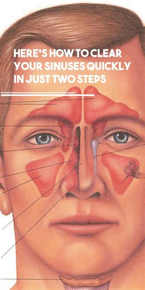 how to open up sinuses fast