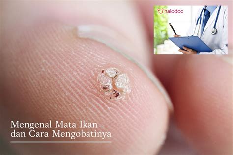 penyakit mata ikan dalchaebi