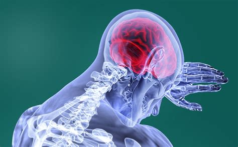 Types of Paralysis: Monoplegia, Hemiplegia, Paraplegia, and Quadriplegia