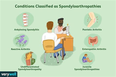 Spondyloarthropathy: Types, Symptoms, & Treatment