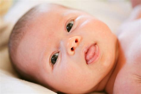 Baby with Allergic Diathesis Stock Image - Image of childhood, facial ...