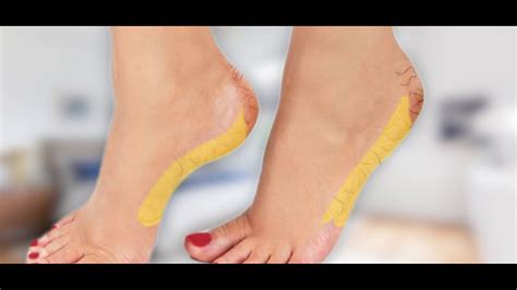 LINK OINTMENT COMMERCIAL COMPLETED WESTERN STYLE - YouTube