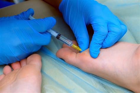 Dermal Fillers - Podiatry Services In Timperley | Footcare | Treatments