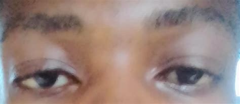 My Skin Is Getting Bad and discoloured.Advice Needed(photos) - Family - Nigeria