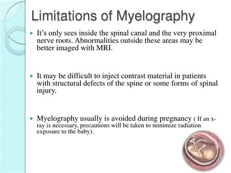 Myelography