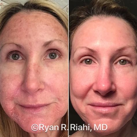 Receive Sun Damage Treatment from a Greater Houston, TX, Dermatologist