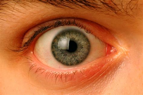Eye color
