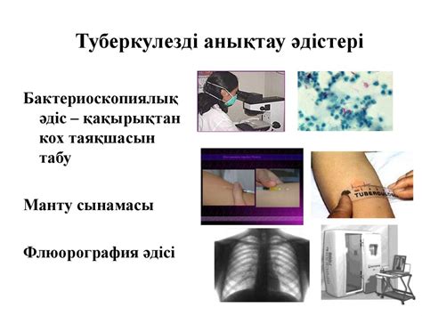 Туберкулез туралы не білеміз? - презентация онлайн
