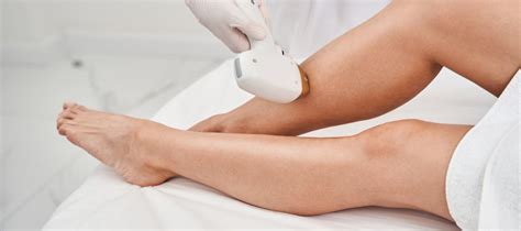 Iilaser Hair Removal Your Complete Guide