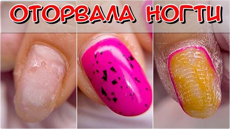 Оторвала ногти / ковыряшка / ковыряет ногти / Маникюр / Преображение ...