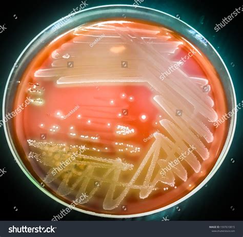 Blood Agar Streptococcus Pyogenes