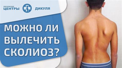 🚶 Причины развития сколиоза, методы коррекции и профилактики. Коррекция ...