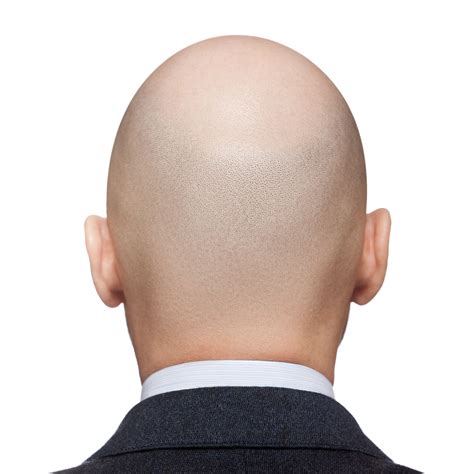 This Easy Test Will Tell You If You’re Going To Go Bald Or Not