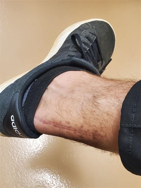 tattoo achilles tendon 6