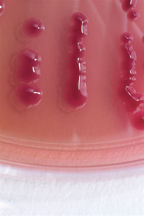 acinetobacter baumannii bacterial culture  science photo library