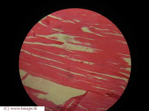 Skeletal Muscle Tissue Histology