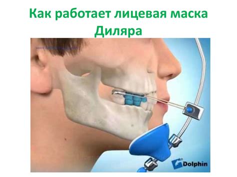 Аппаратурный метод лечения в стоматологии - online presentation