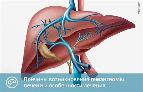 Гемангиома печени. Причины возникновения у взрослых. Лечение